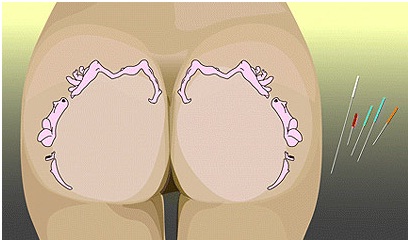 רפואה מהתחת