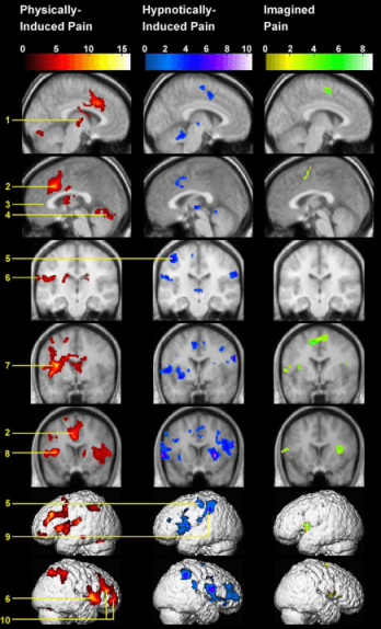 כאב מושרה לעומת אמיתי