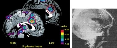 סבל לעומת תחושת כאב